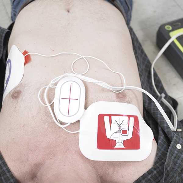 ZOLL CPR Stat-Padz -elektrodi